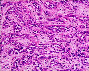 gastroenterology:颠覆常规!提出癌症起源新观点